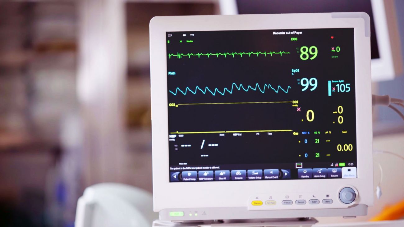 Elettrocardiogramma (ECG)